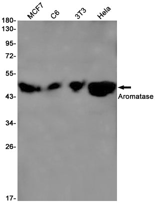 Aromatase Rabbit Monoclonal Antibody