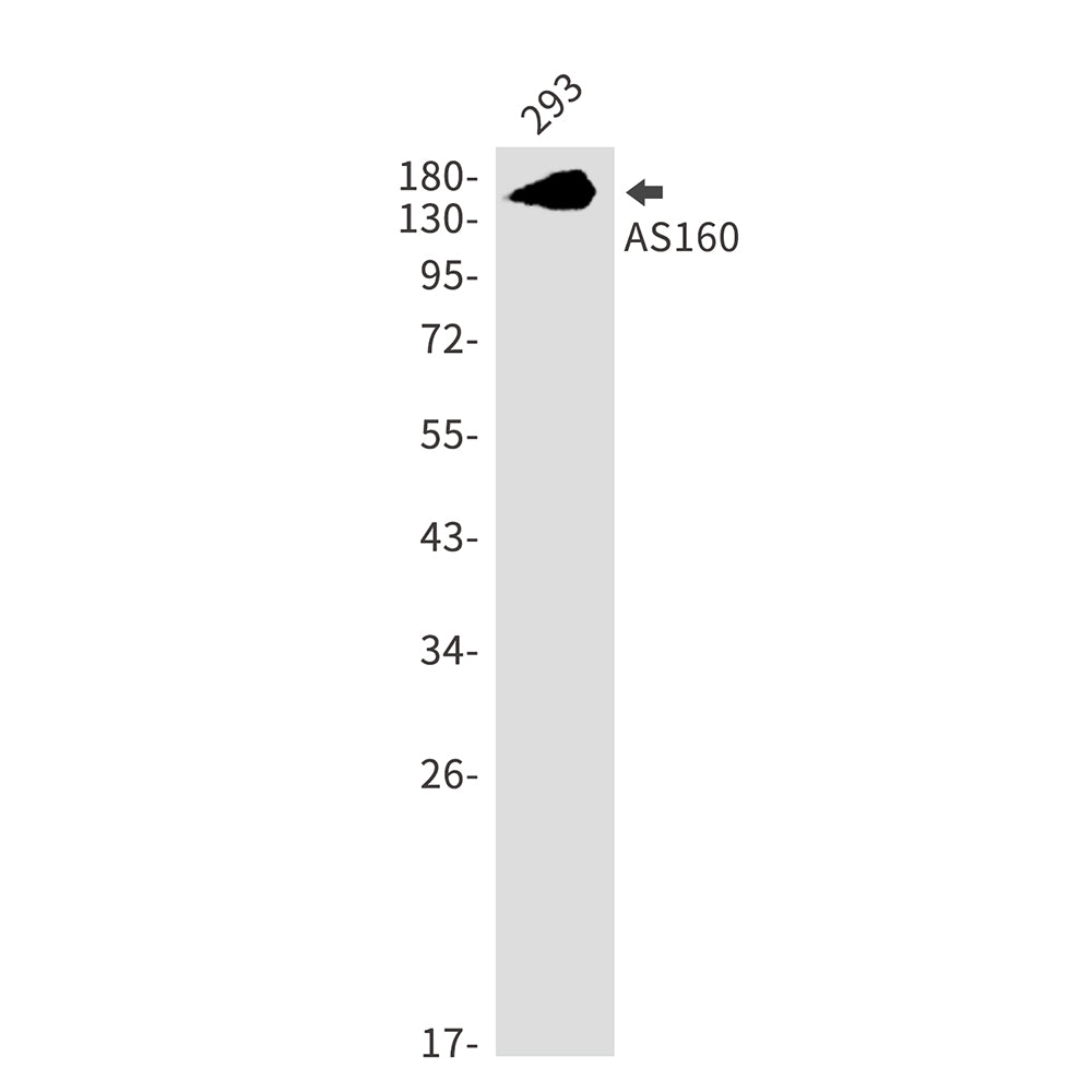 AS160 Rabbit Monoclonal Antibody