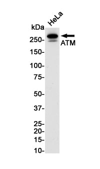 ATM Rabbit Monoclonal Antibody