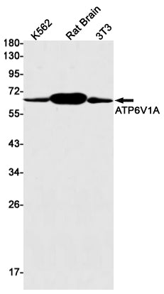 ATP6V1A Rabbit Monoclonal Antibody