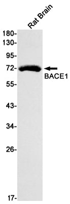 BACE1 Rabbit Monoclonal Antibody
