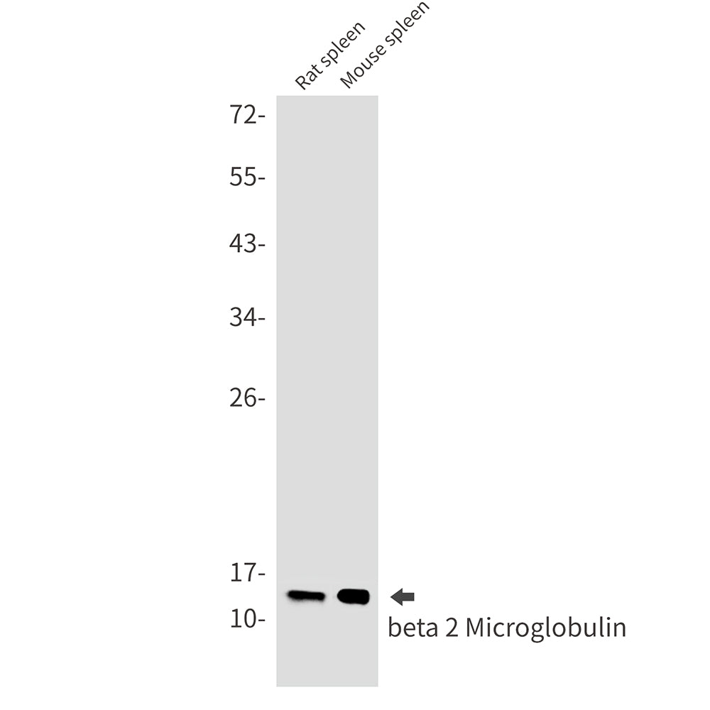 beta 2 Microglobulin Rabbit Monoclonal Antibody