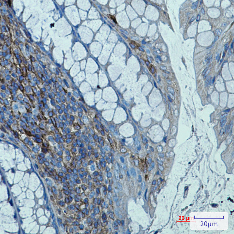 beta 2 Microglobulin Rabbit Monoclonal Antibody