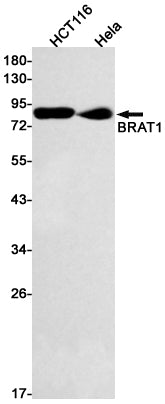 BRAT1 Rabbit Monoclonal Antibody