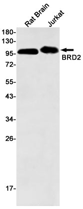BRD2 Rabbit Monoclonal Antibody