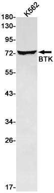 BTK Rabbit Monoclonal Antibody