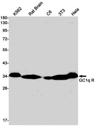 GC1q R Rabbit Monoclonal Antibody