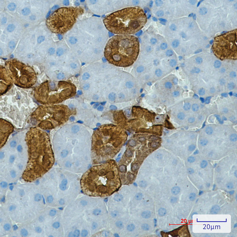 Calbindin Rabbit Monoclonal Antibody