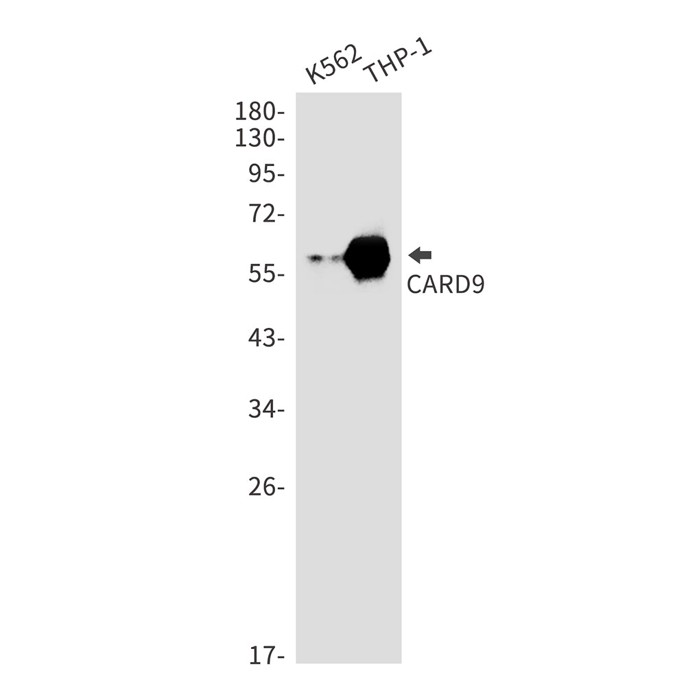 CARD9 Rabbit Monoclonal Antibody