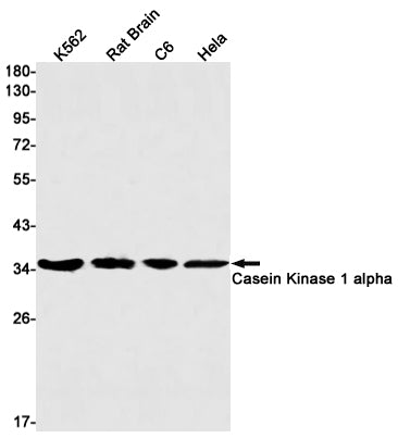 Casein Kinase 1 alpha Rabbit Monoclonal Antibody