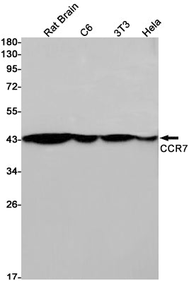 CCR7 Rabbit Monoclonal Antibody