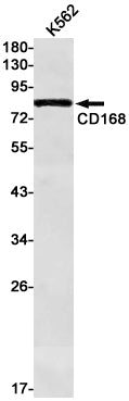 CD168 Rabbit Monoclonal Antibody