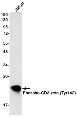 Phospho-CD3 zeta (Tyr142) Rabbit Monoclonal Antibody