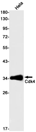 CDK4 Rabbit Monoclonal Antibody