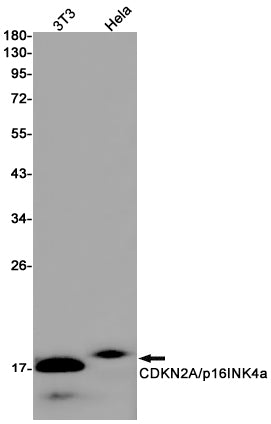 CDKN2A/p16INK4a Rabbit Monoclonal Antibody