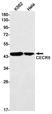CECR5 Rabbit Monoclonal Antibody