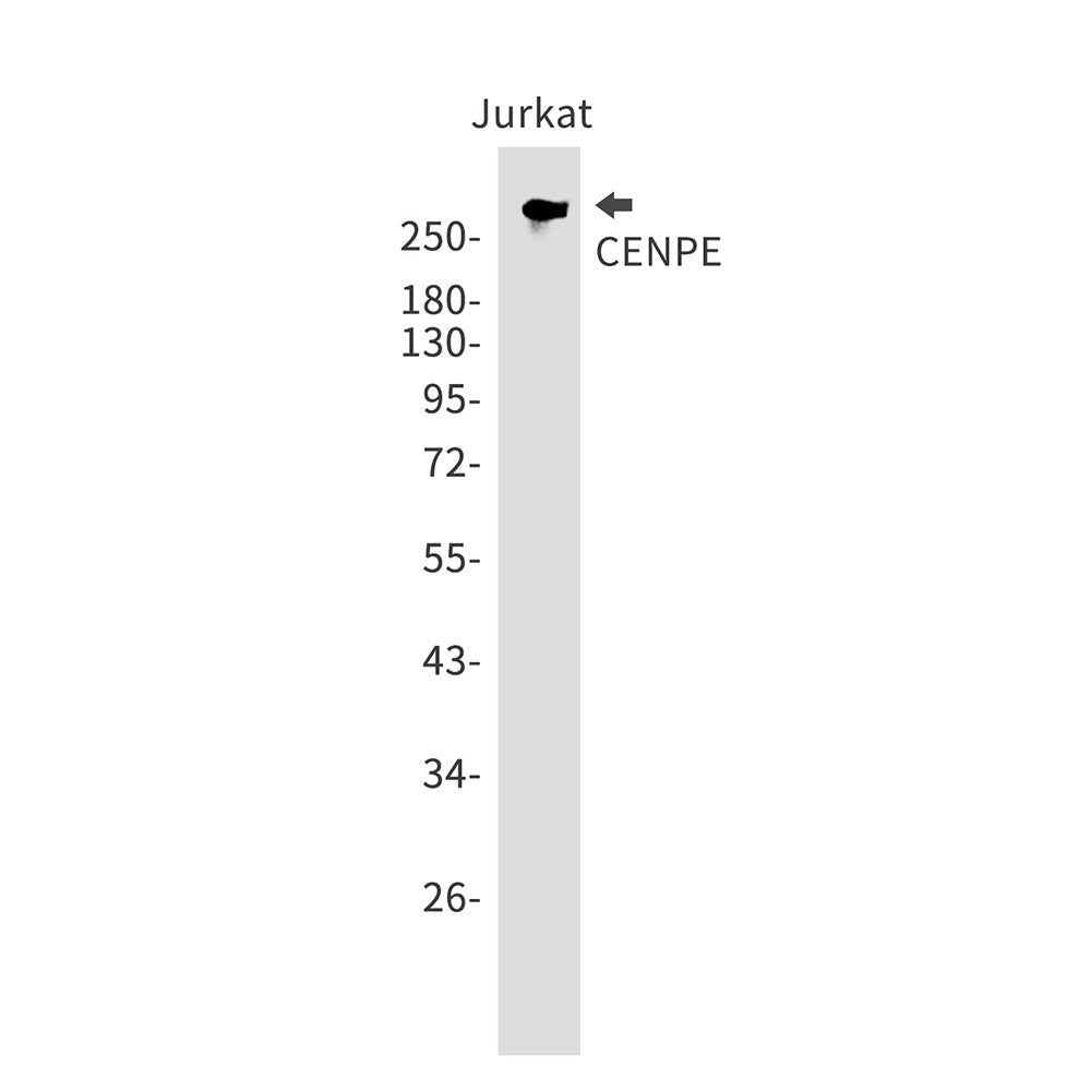 CENPE Rabbit Monoclonal Antibody