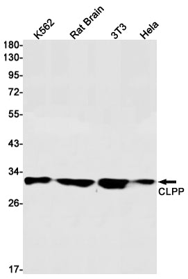 CLPP Rabbit Monoclonal Antibody