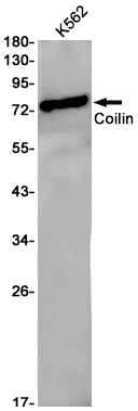 Coilin Rabbit Monoclonal Antibody