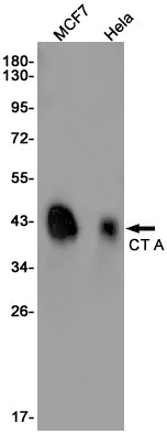 CT A Rabbit Monoclonal Antibody