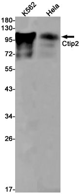 Ctip2 Rabbit Monoclonal Antibody