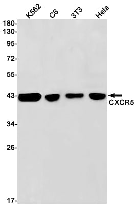 CXCR5 Rabbit Monoclonal Antibody
