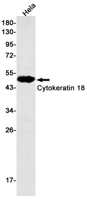 Cytokeratin 18 Rabbit Monoclonal Antibody
