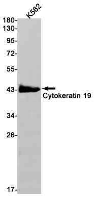 Cytokeratin 19 Rabbit Monoclonal Antibody