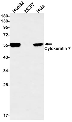 Cytokeratin 7 Rabbit Monoclonal Antibody
