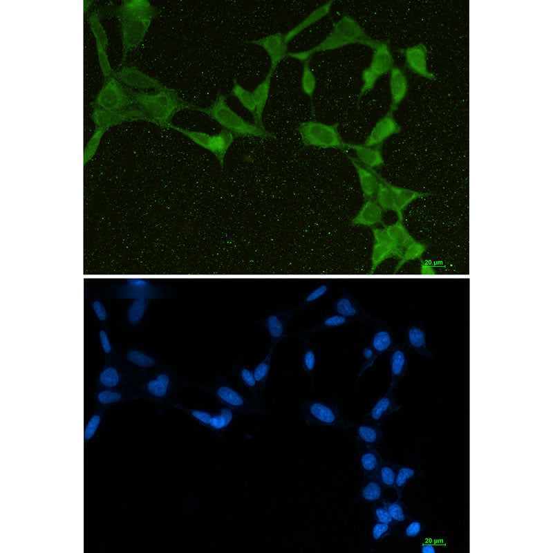 DDX21 Rabbit Monoclonal Antibody
