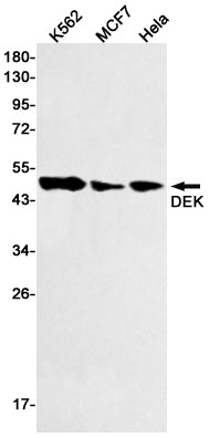 DEK Rabbit Monoclonal Antibody