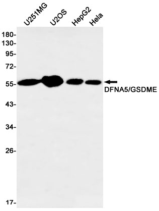 GSDME Rabbit Monoclonal Antibody