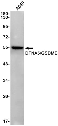 GSDME Rabbit Monoclonal Antibody