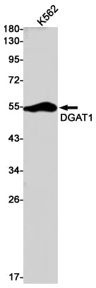 DGAT1 Rabbit Monoclonal Antibody