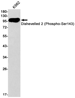 Phospho-Dishevelled 2 (Ser143) Rabbit Monoclonal Antibody