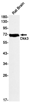 DKK3 Rabbit Monoclonal Antibody