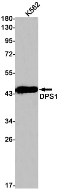 DPS1 Rabbit Monoclonal Antibody