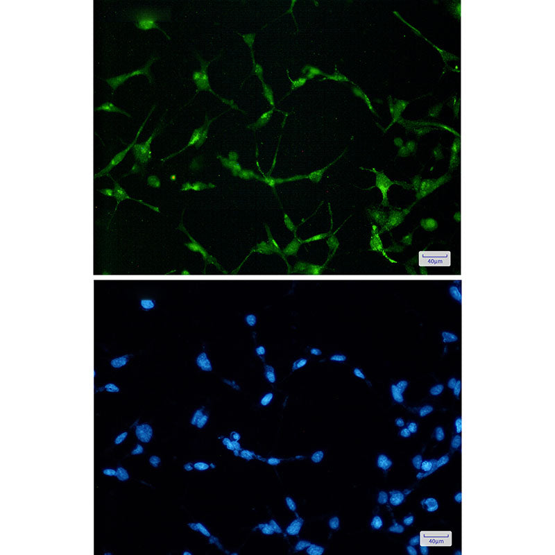 EWSR1 Rabbit Monoclonal Antibody