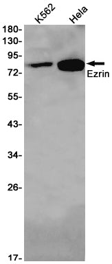 Ezrin Rabbit Monoclonal Antibody