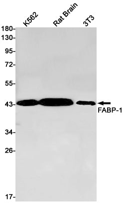 Aspartate Aminotransferase Rabbit Monoclonal Antibody
