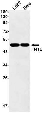 FNTB Rabbit Monoclonal Antibody