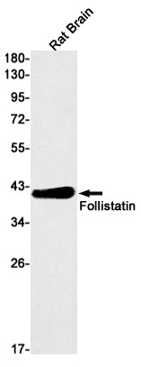 Follistatin Rabbit Monoclonal Antibody