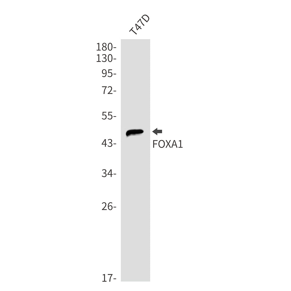 FOXA1 Rabbit Monoclonal Antibody