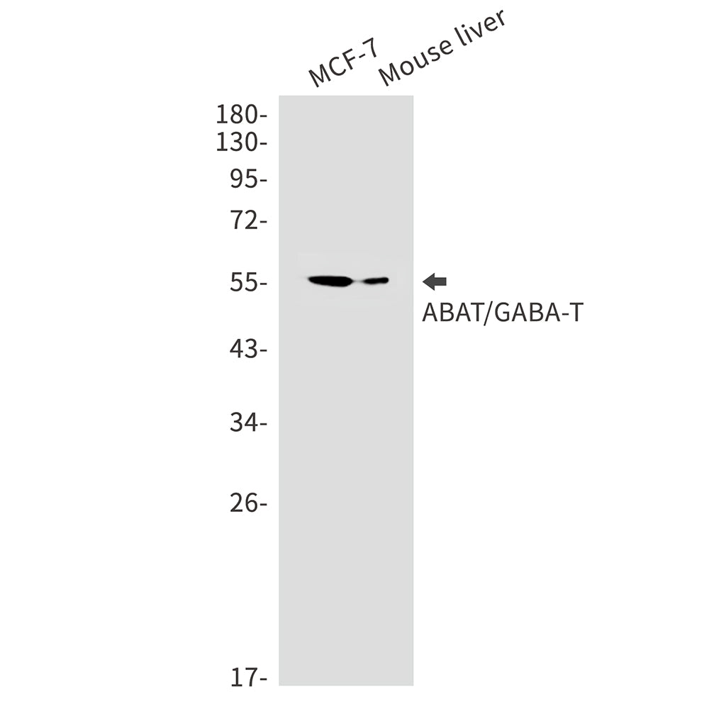 ABAT Rabbit Monoclonal Antibody