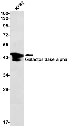 Galactosidase alpha Rabbit Monoclonal Antibody