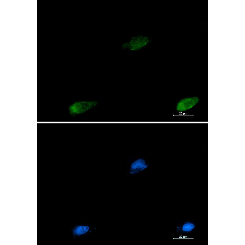 Galectin 3 Rabbit Monoclonal Antibody