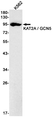 KAT2A Rabbit Monoclonal Antibody