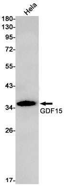 GDF15 Rabbit Monoclonal Antibody