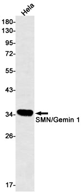 SMN Rabbit Monoclonal Antibody