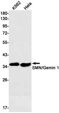 SMN Rabbit Monoclonal Antibody